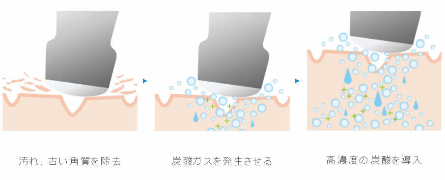 富士市こだわり美肌エステサロンのエクラ・アン・プリュスの炭酸導入・マッサージ