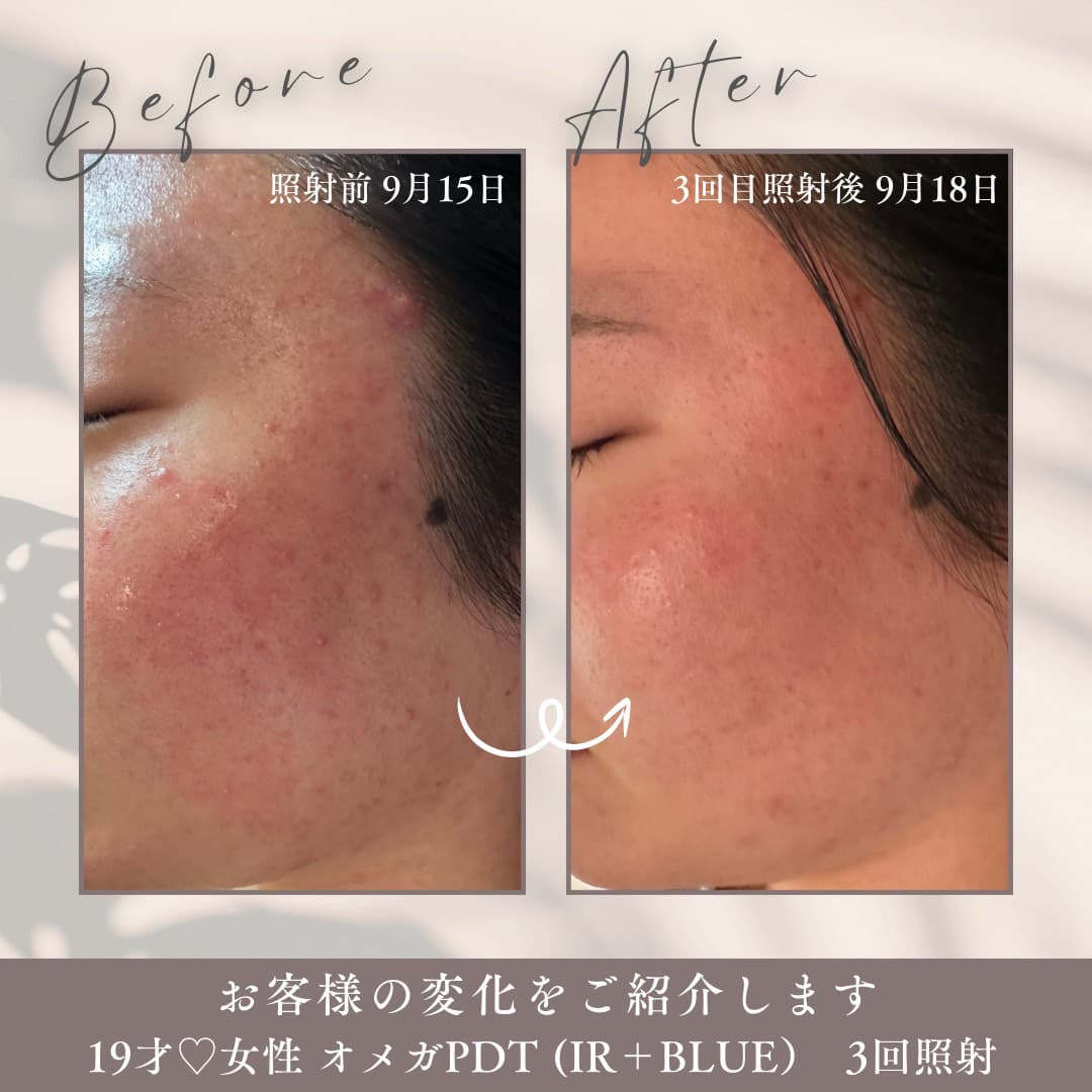 オメガＰＤＴのお客様の変化をご紹介いたします。