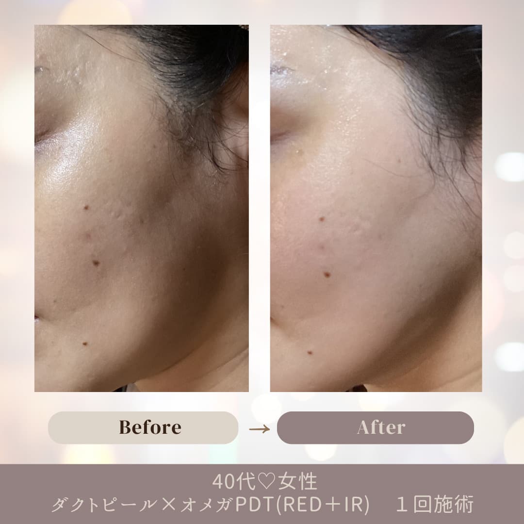 オメガＰＤＴのお客様の変化をご紹介いたします。