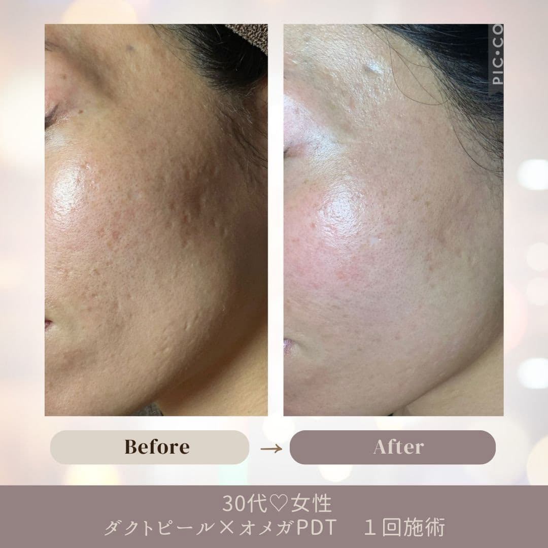 オメガＰＤＴのお客様の変化をご紹介いたします。